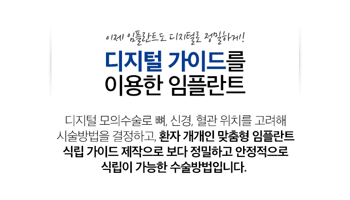 디지털 가이드를 이용한 임플란트
