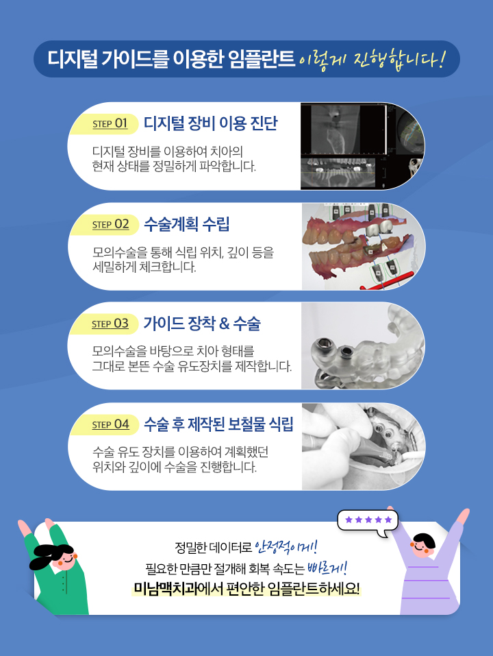 디지털 가이드를 이용한 임플란트