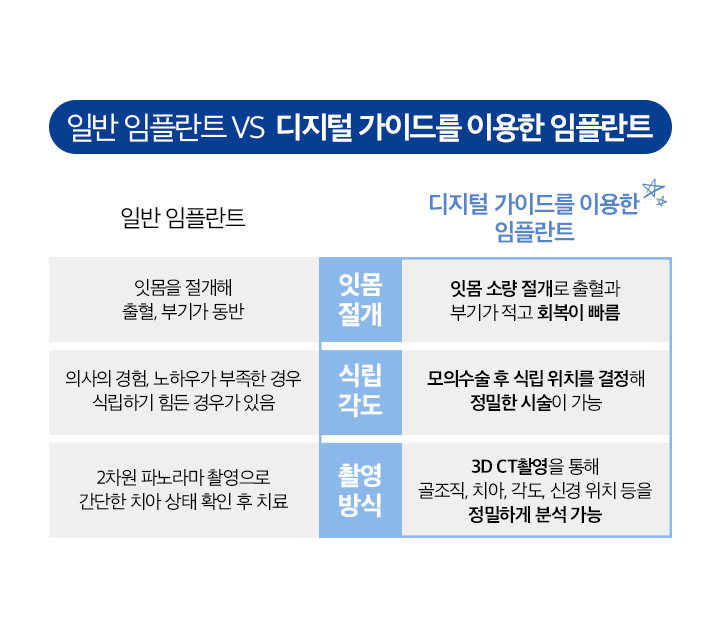 디지털 가이드를 이용한 임플란트