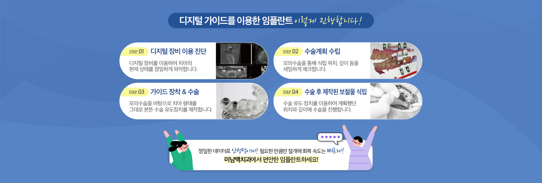 디지털 가이드를 이용한 임플란트