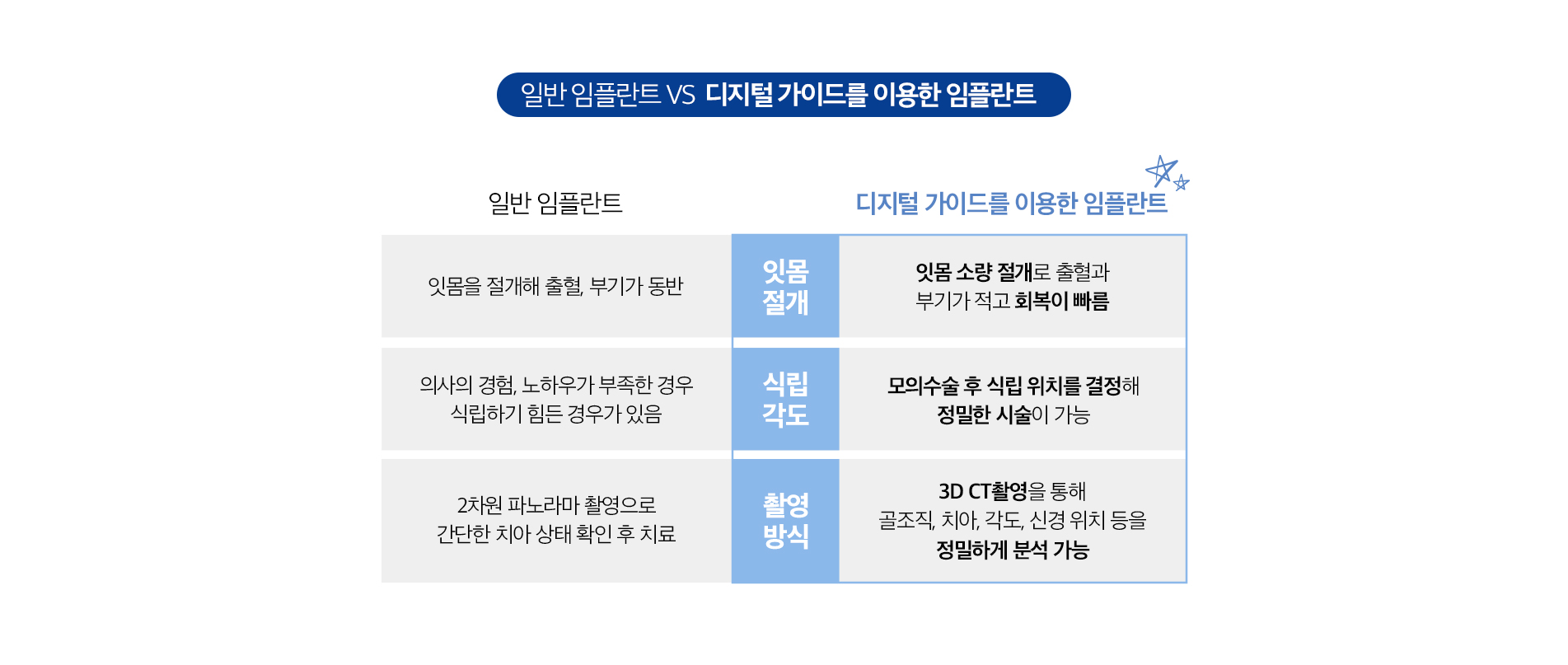 디지털 가이드를 이용한 임플란트