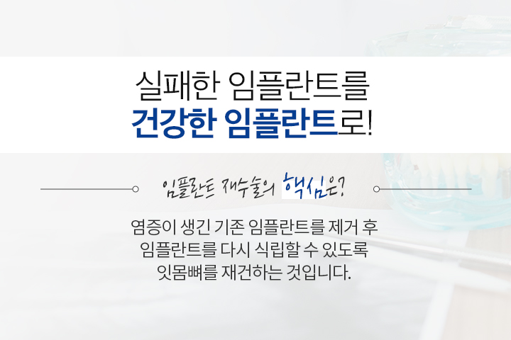 임플란트 재수술