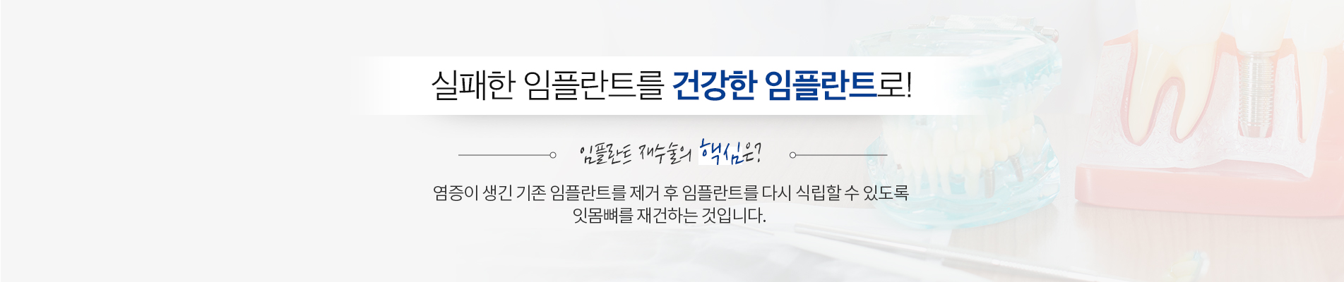 임플란트 재수술