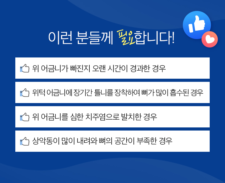상악동 거상술