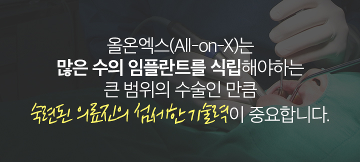 올온엑스(All-on-X)