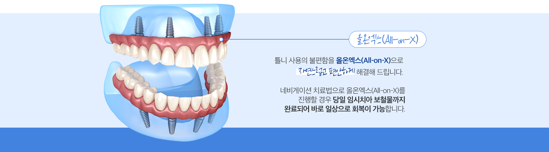 올온엑스(All-on-X)
