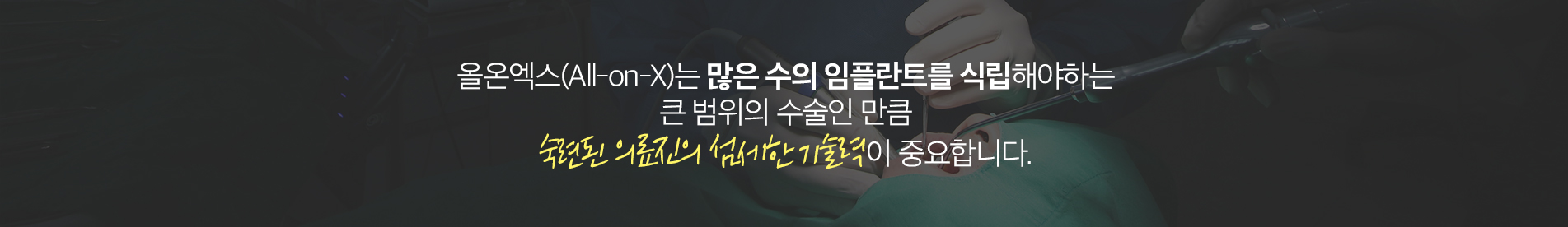 올온엑스(All-on-X)