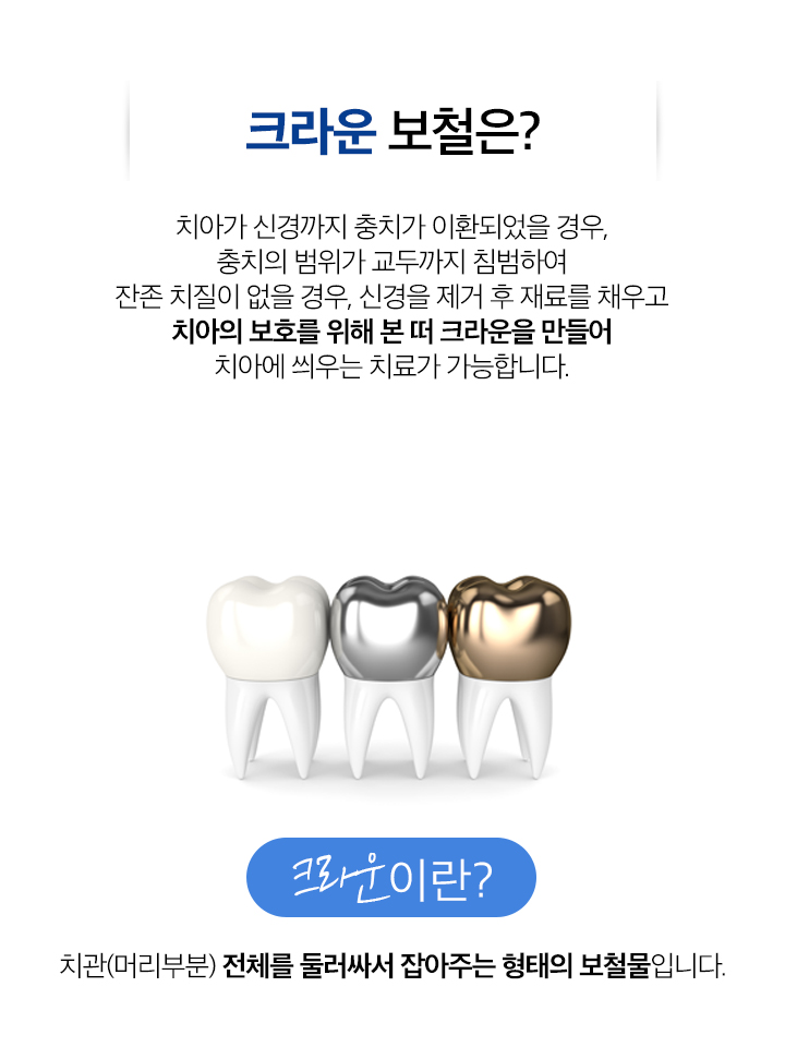 크라운보철