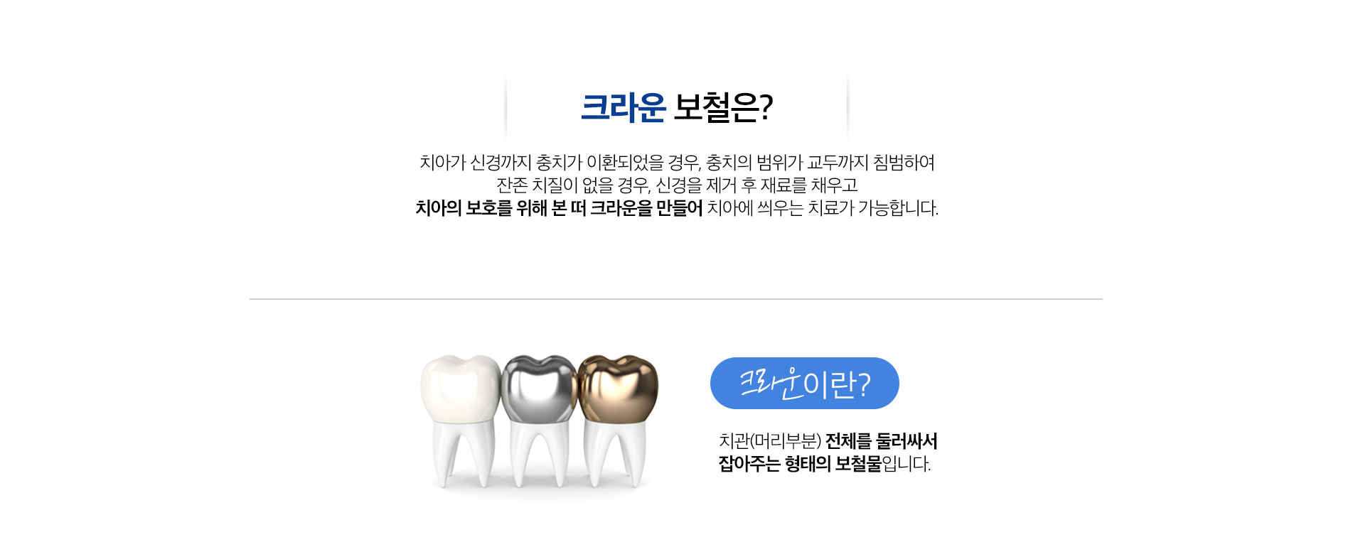 크라운보철