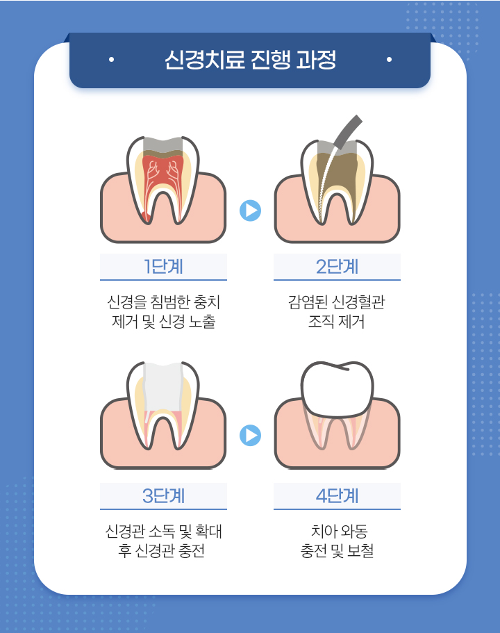 신경치료