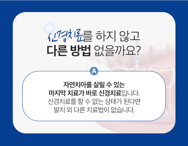 신경치료