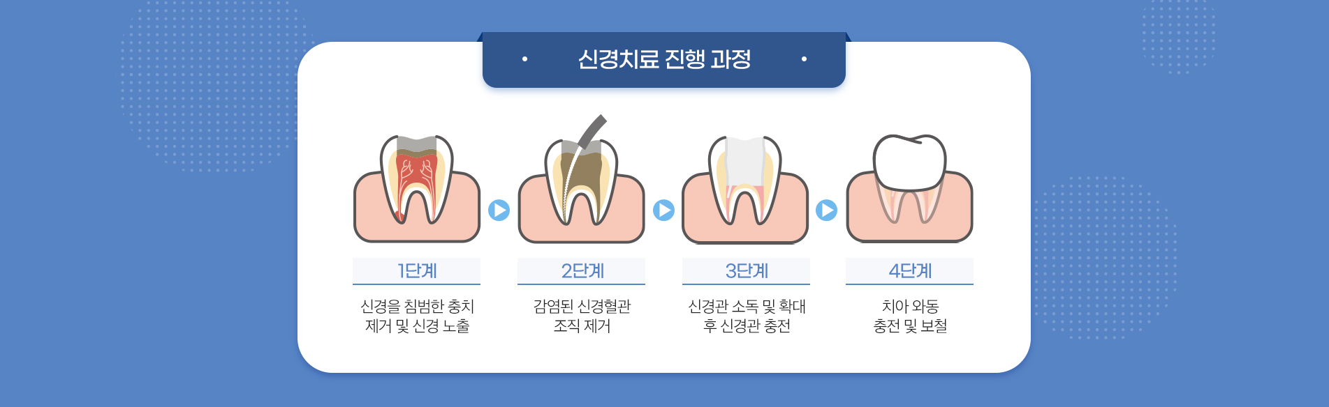 신경치료