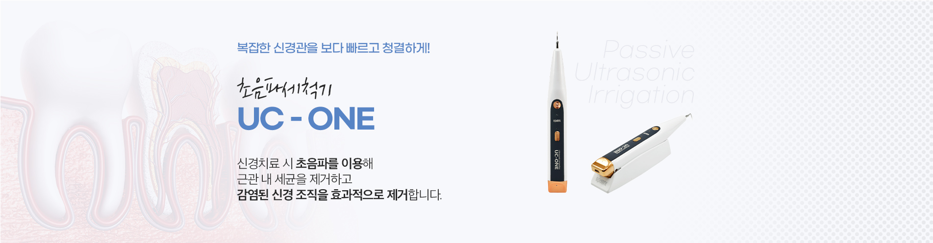 신경치료