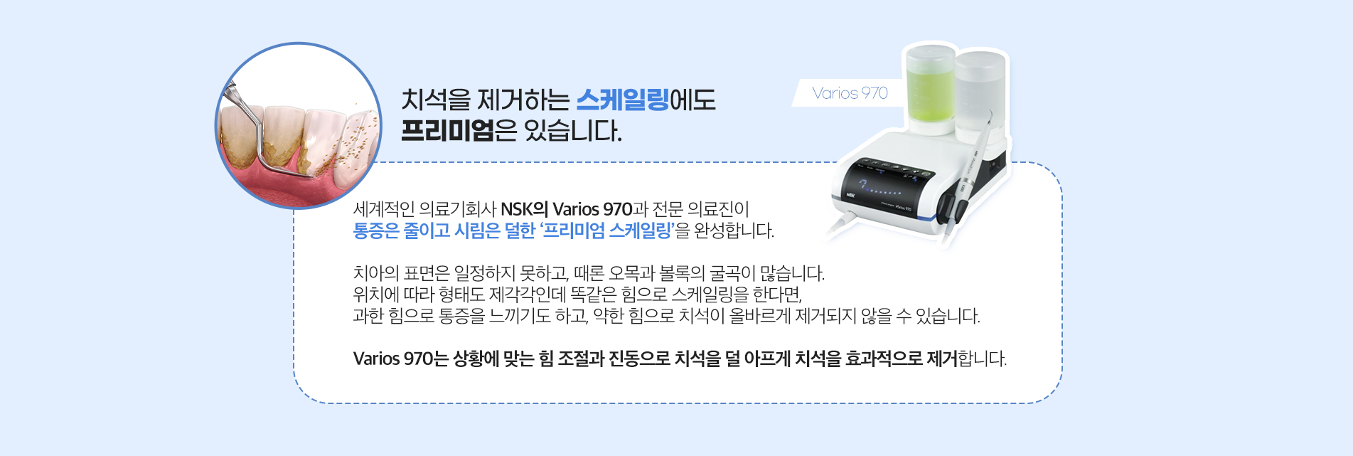 스케일링