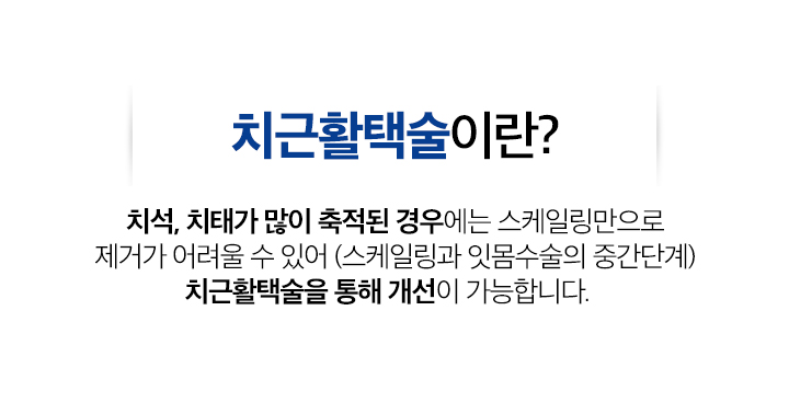 치근활택술