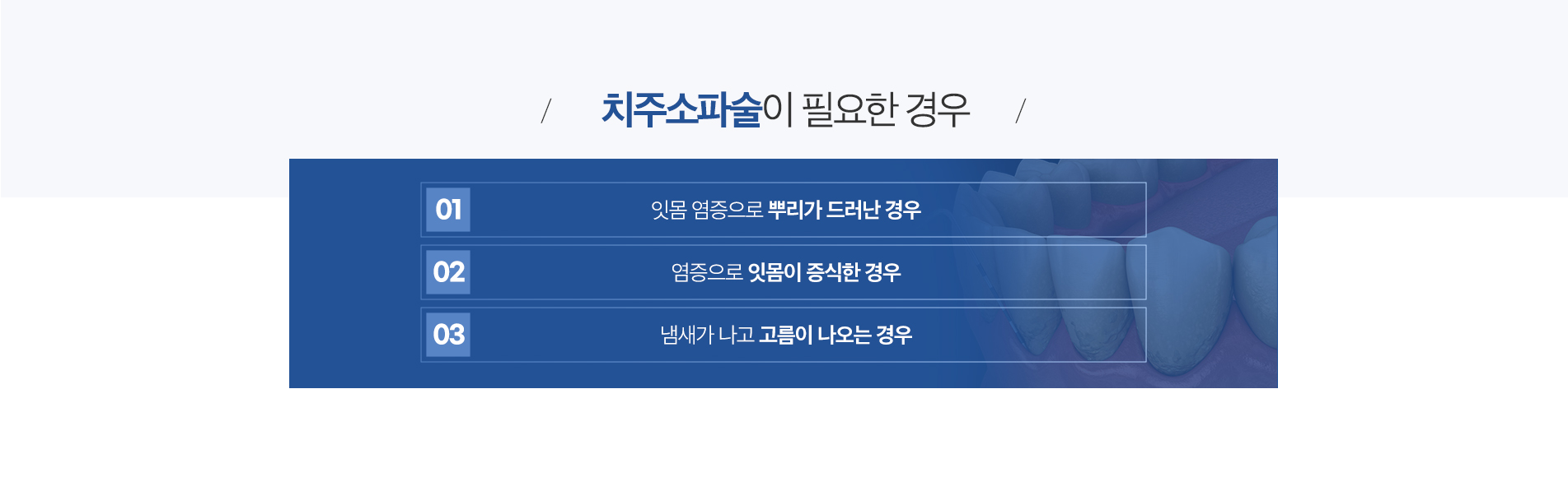 치주소파술