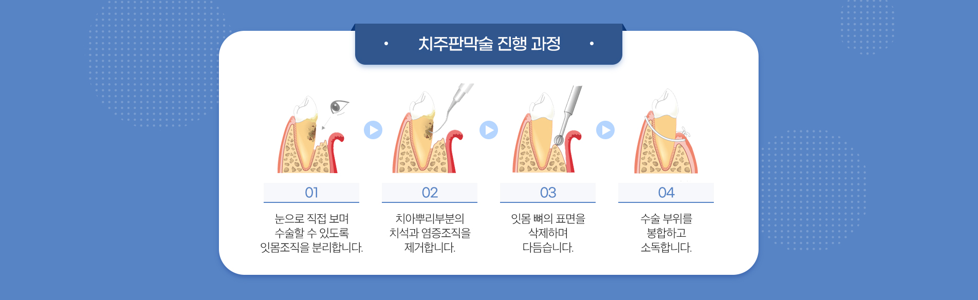 치주판막술