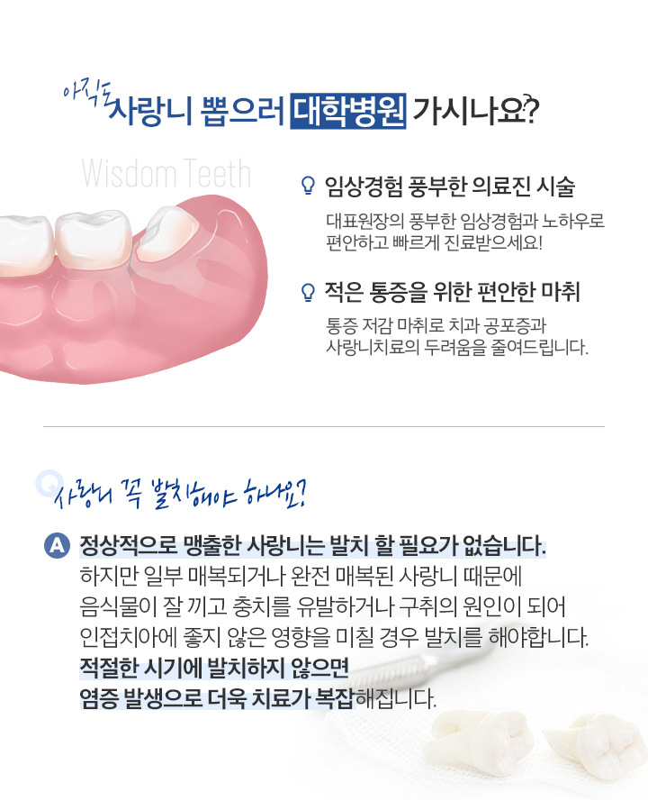 사랑니발치