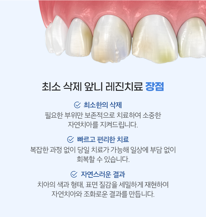 최소삭제 앞니 레진치료