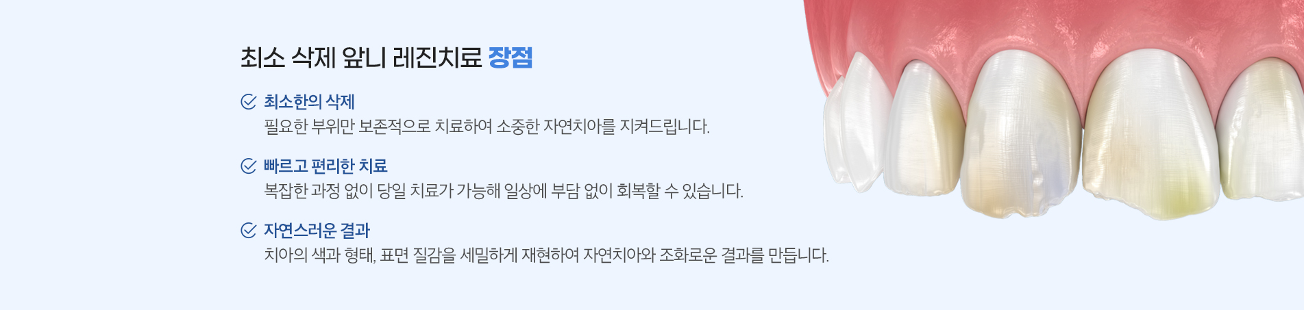 최소삭제 앞니 레진치료