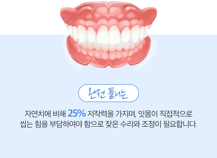 완전틀니