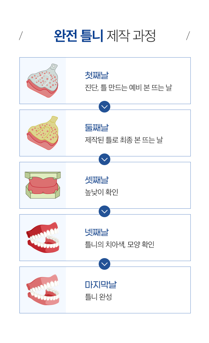 완전틀니