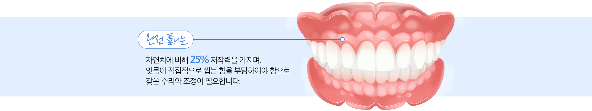 완전틀니