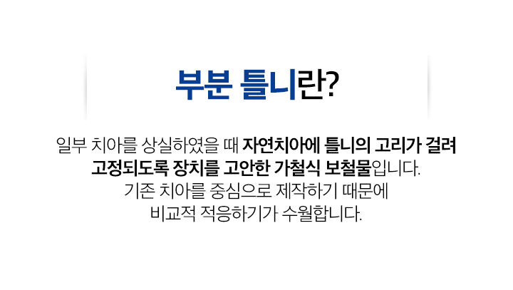 부분틀니