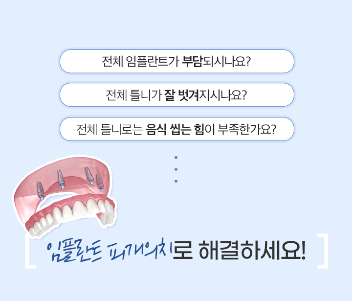 임플란트 피개의치